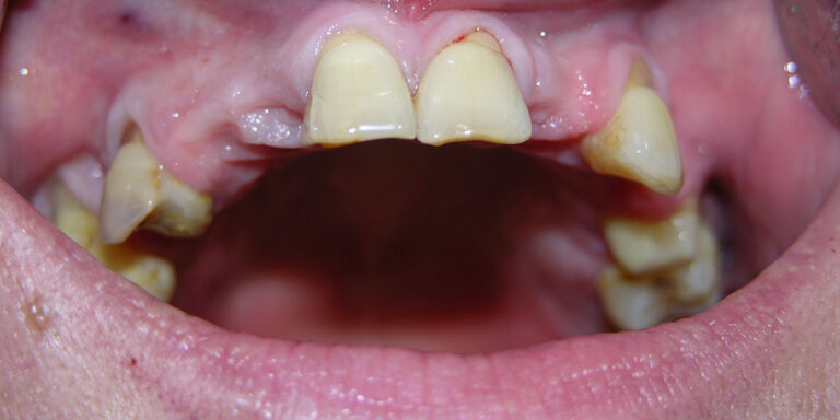 Metamorfoza 1 - przed