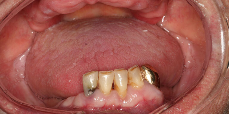 Metamorfoza 7 - przed