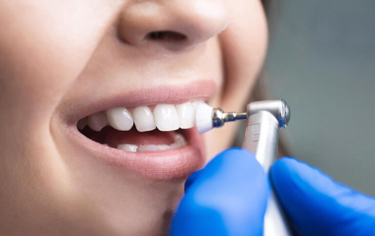 leczenie próchnicy szczecin