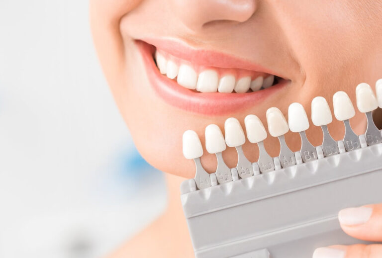 wybielanie zębów szczecin